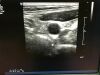 PHILIPS IU 22 Ultrasound - Cardiac - Vascular