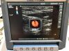 SONOSITE Micromaxx Ultrasound - Shared Service