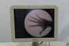 PHILIPS Veradius C-Arm